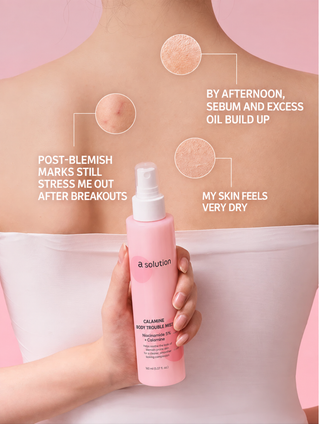 A Solution - Calamine Body Trouble Mist 150ml
