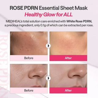 Mediheal - British White Rose PDRN Mask 5pcs - Koreabe