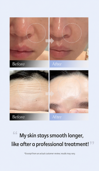 Arocell - Маска Botulcare Primetox 20 шт.