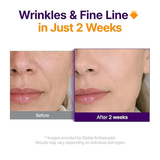 Purito — сыворотка Retinol Retinal 2000 NAD+ Serum, 30 мл