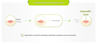 Dong A - Noscardin (NEW) 18g (For Post Acne Healing) - Koreabe