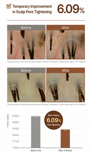 Modamoda - Ампула для кожи головы Scalp Lab RX Gwaisa, 100 мл