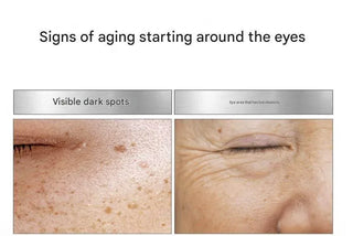 Medipeel - Melanonx Dark Spot Eye Cream 20ml - Koreabe