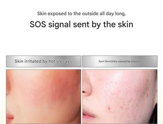 Medipeel - Melanonx Dark Spot Spot Gel 15ml - Koreabe
