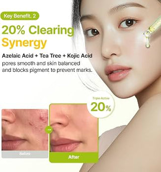 Purito - Azelaic Acid 10 Kojic Tea Tree Serum 30ml