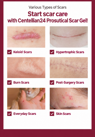 Centellian24 - Proceutical Scar Gel 15ml