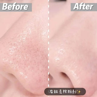 Dong A - Aclean 20g - Koreabe