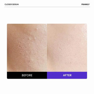 Frankly - Closer Pore Reducing Serum 60ml - Koreabe