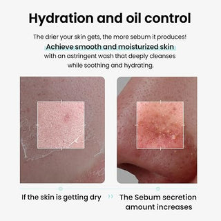 Ilso - Гидрофильное масло Super Melting Sebum 200мл