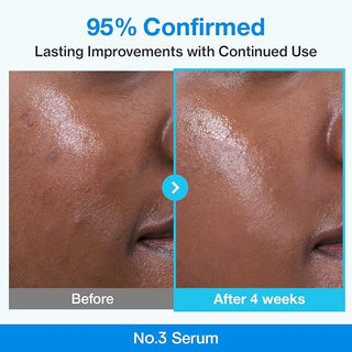 Numbuzin - Сыворотка для сужения пор с биоретинолом Blu Bio Retinol Pore Refining Serum 30мл