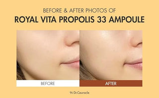 Dr Ceuracle - Royal Vita Propolis 33 Ampoule 30мл