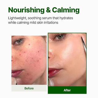 Nacific - Cica PDRN Calming Serum 50ml