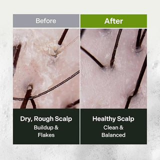 Daleaf - Better Root Relaxing Shampoo 1000ml