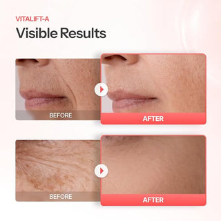 Dr Different - Vitalift A Cream 20мл