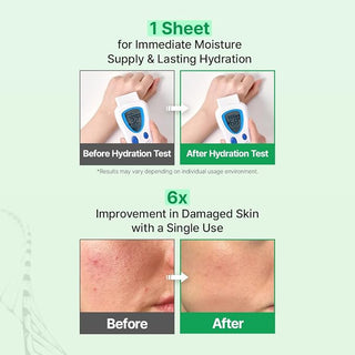 Zipiderm — EGF Маска-повязка для восстановления кожного барьера, 4 шт.