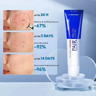 Pair Acne Cream 14g - Koreabe