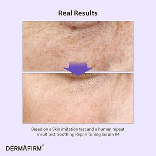 Dermafirm - Soothing Repair Toning Serum R4 - 30ml - Koreabe