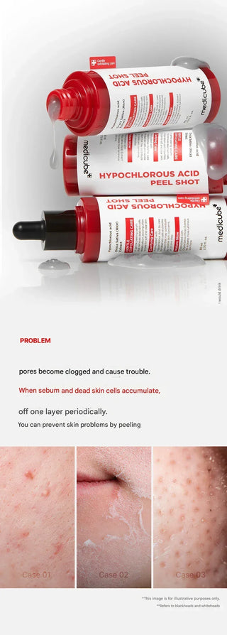 Medicube - Hypochlorous Acid Peel Shot 80ml - Koreabe