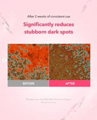 Aprilskin - TXA Purity 99% Ampoule - Koreabe