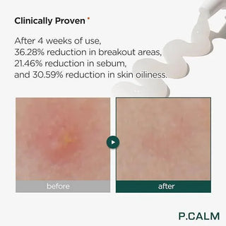 P Calm Centella Trouble Spot 15 ml - Koreabe