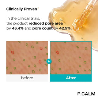 P Calm Retinolagen Ampoule 30 ml - Koreabe