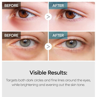 Dr Melaxin - TX Retinalsome Double Effect Eye Cream 40g - Koreabe