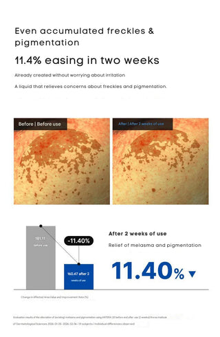 Dong A — Жидкость Pigmentation Pro 30мл