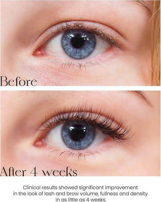 Son&Park Real Eyelash Serum Clear 15g - Koreabe